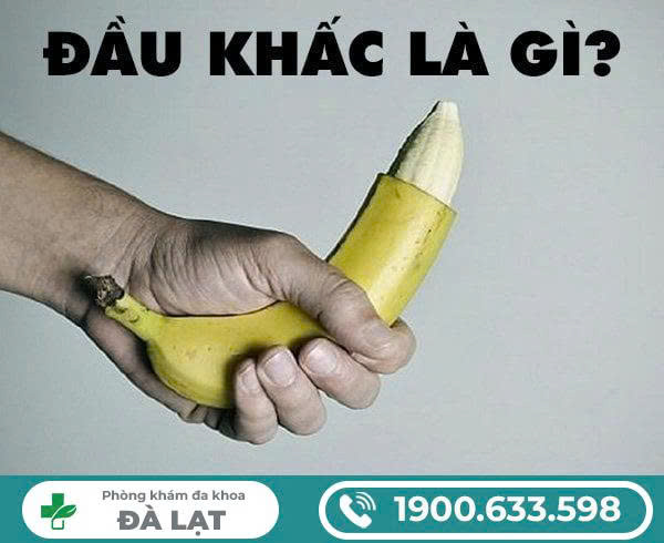 Hình ảnh minh họa